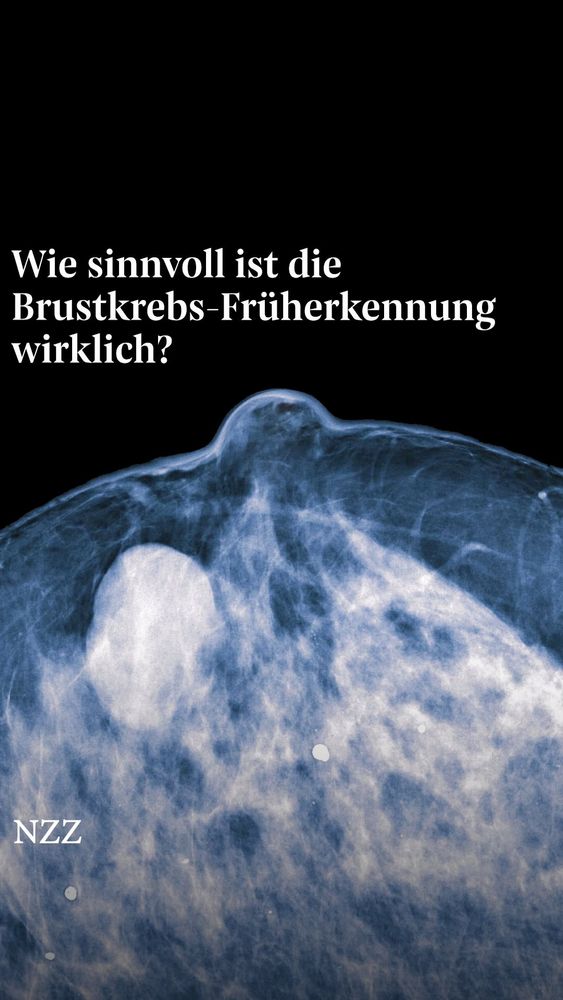 Wie sinnvoll ist die Brustkrebs-Früherkennung wirklich?